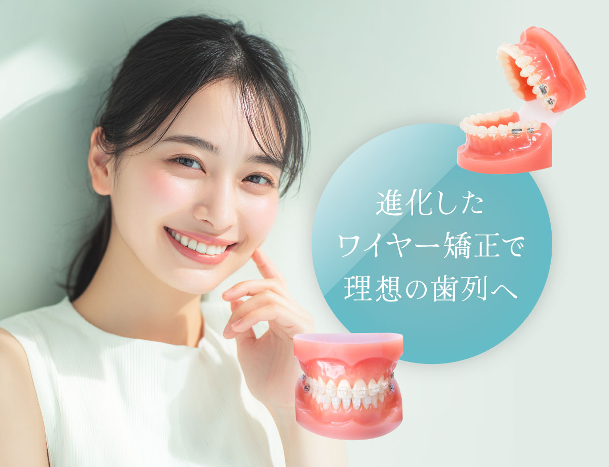 進化したワイヤー矯正で理想の歯列へ
